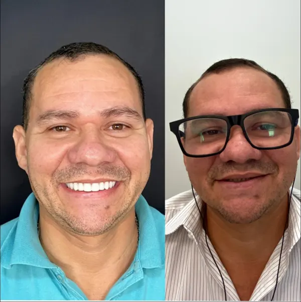 homem 40 anos antes e depois